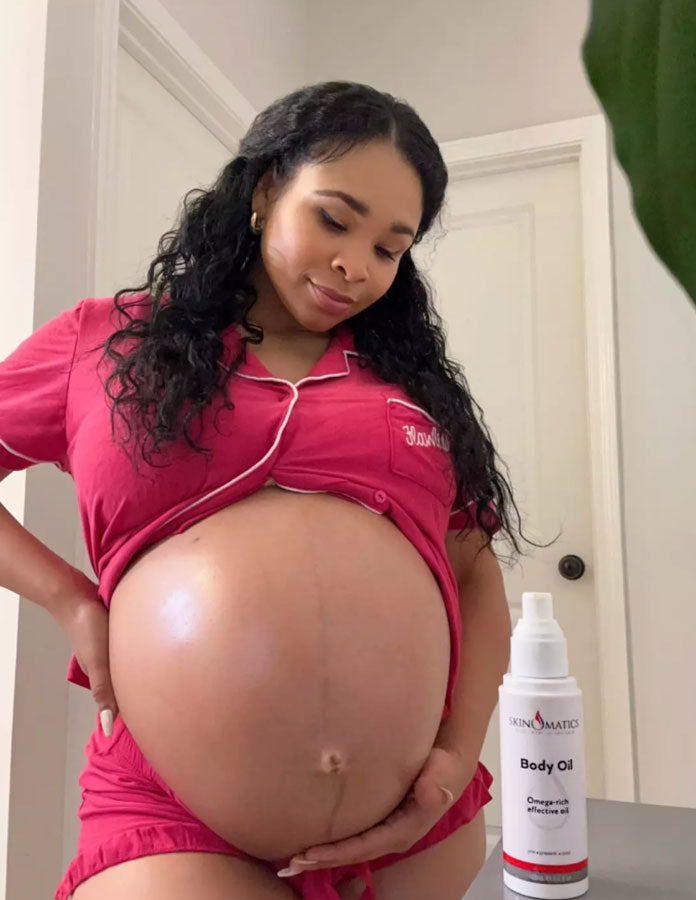 Erica..